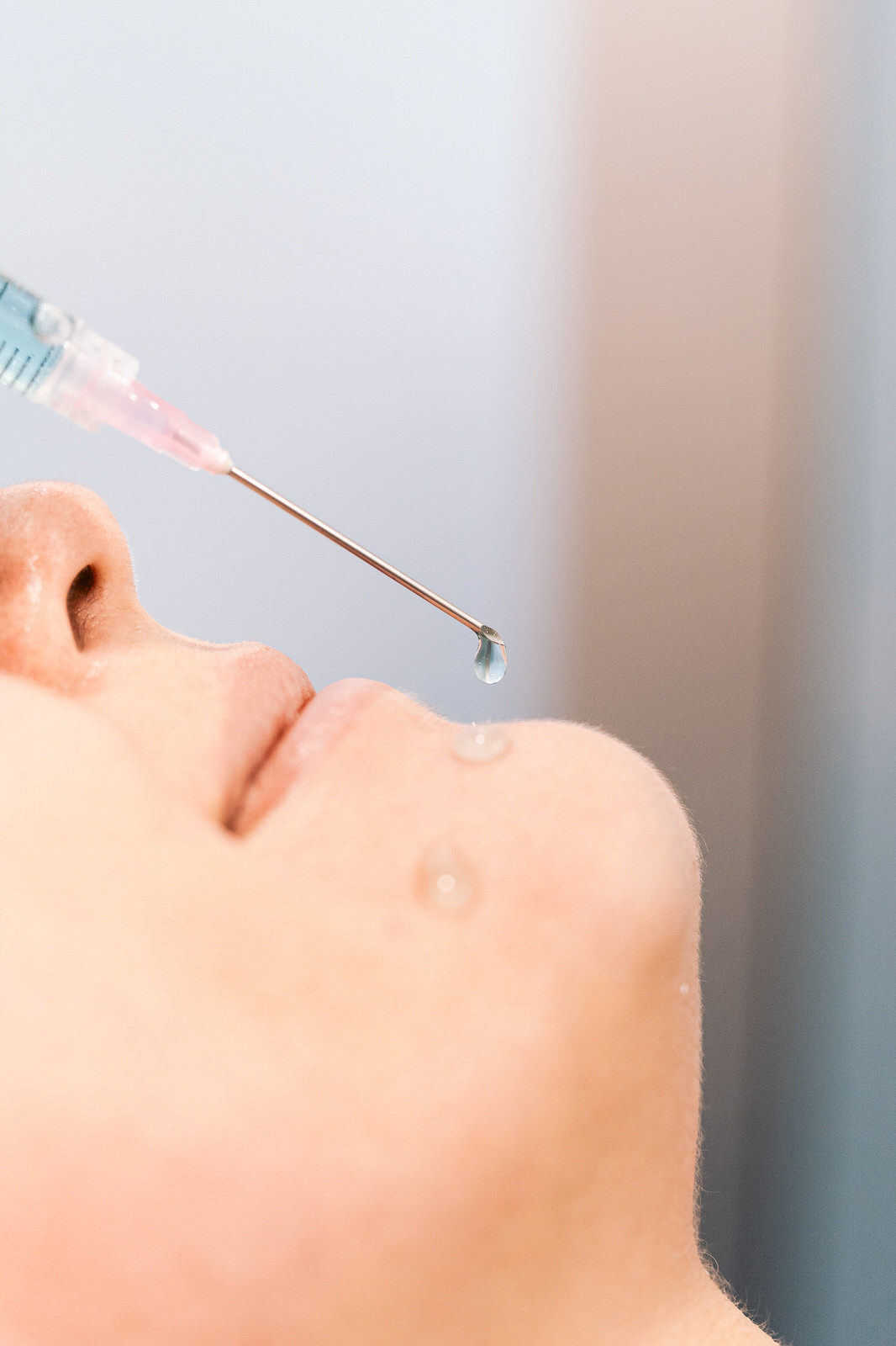 CDM Medical — Aguja nariz paciente primer plano